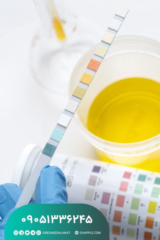 نوار ادرار ۱۴ پارامتری چیست و چه کاربردی دارد؟