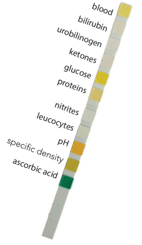 نوار ادرار چند پارامتری
