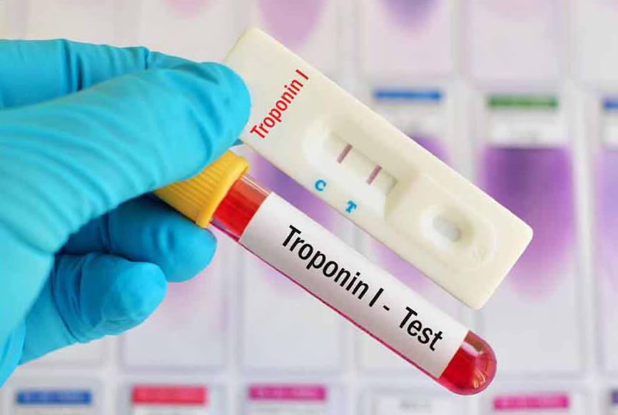 رپید تست تروپونین