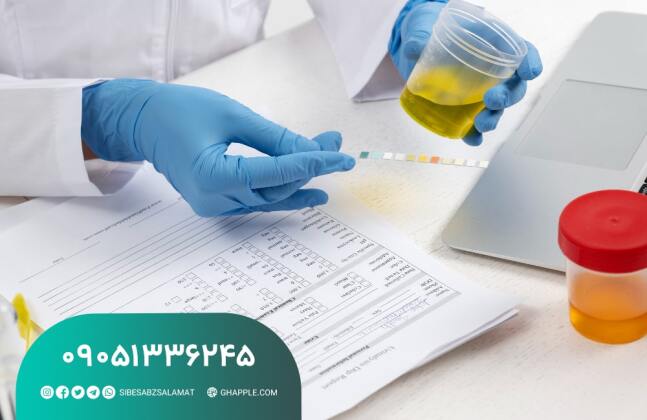 مراحل راه‌اندازی خط تولید نوار ادرار ۱۴ پارامتری