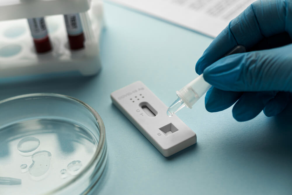 انواع کیت تشخیص سریع دنگی